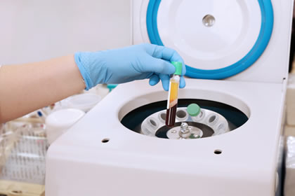 prp injections